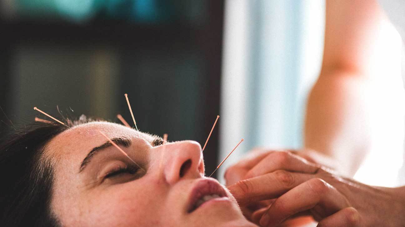 5840  woman facial acupuncture 1296x728 header