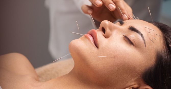 Cosmetic and Facial Acupuncture